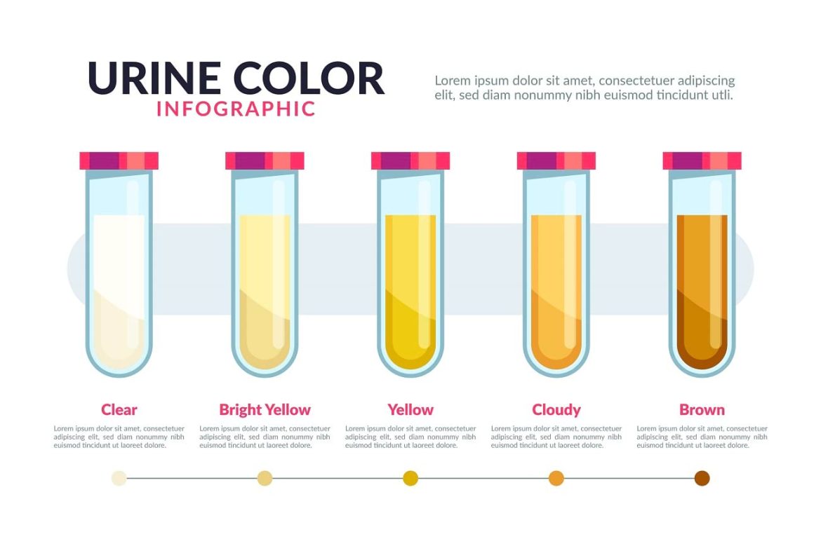 Convenience and accuracy: exploring at-home urine tests