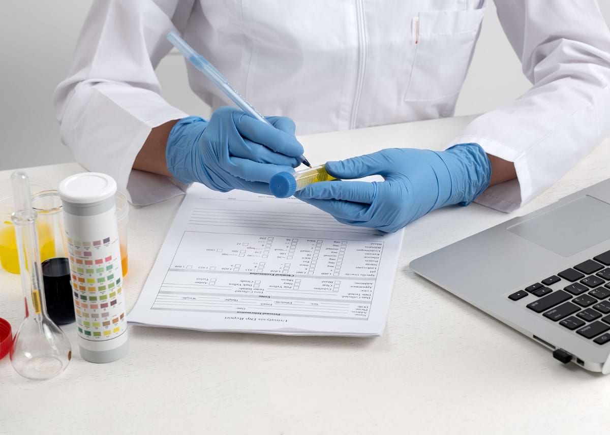at-home urine test